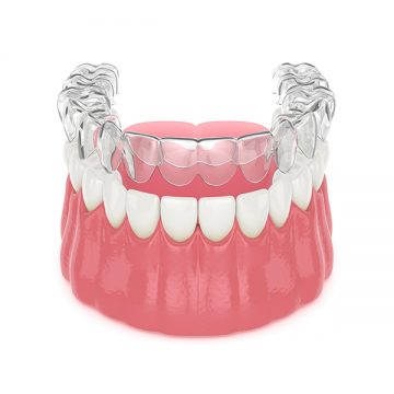 Who is A Good Candidate for Clear Aligners?