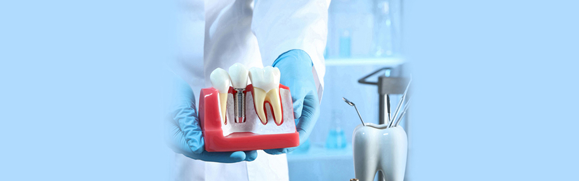 Understanding the Lifespan and Benefits of Dental Implants